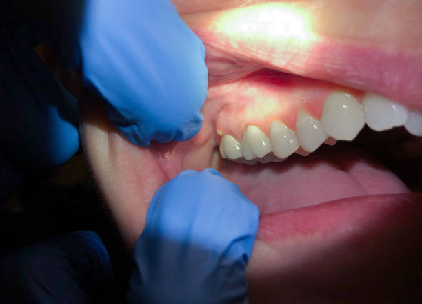 Best Emergency Orthodontic Repairs in East Troy, WI